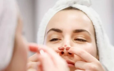 Punya Jerawat di Hidung? Ini Penyebab dan Cara Mengatasinya dengan Efektif