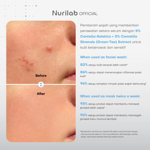 NURILAB 3X Defense Gentle Cleansing Gel - Image 2
