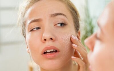 Kulit Kering? Ini Tips dan Skincare yang Ampuh Menghidrasi Wajah