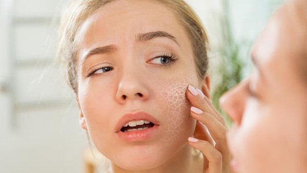 Kulit Kering? Ini Tips dan Skincare yang Ampuh Menghidrasi Wajah