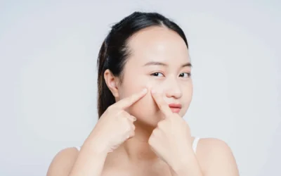 Bahan Skincare yang Dapat Menyebabkan Jerawat