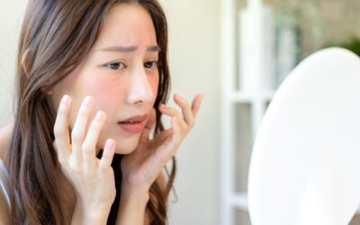 Sensitive Skin vs Acne-Prone: Perbedaan dan Cara Rawatnya