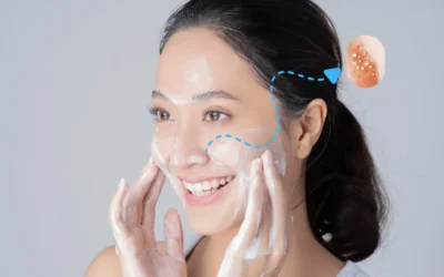 Apakah Facial Wash Bisa Menghilangkan Komedo?