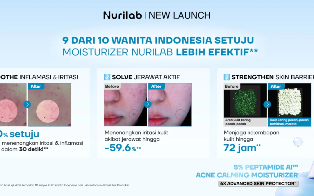 Acne Calming Moisturizer